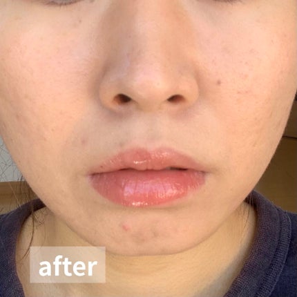 パワー プランピング リップ グロス/Too Faced/リップグロスを使ったクチコミ(10枚目)