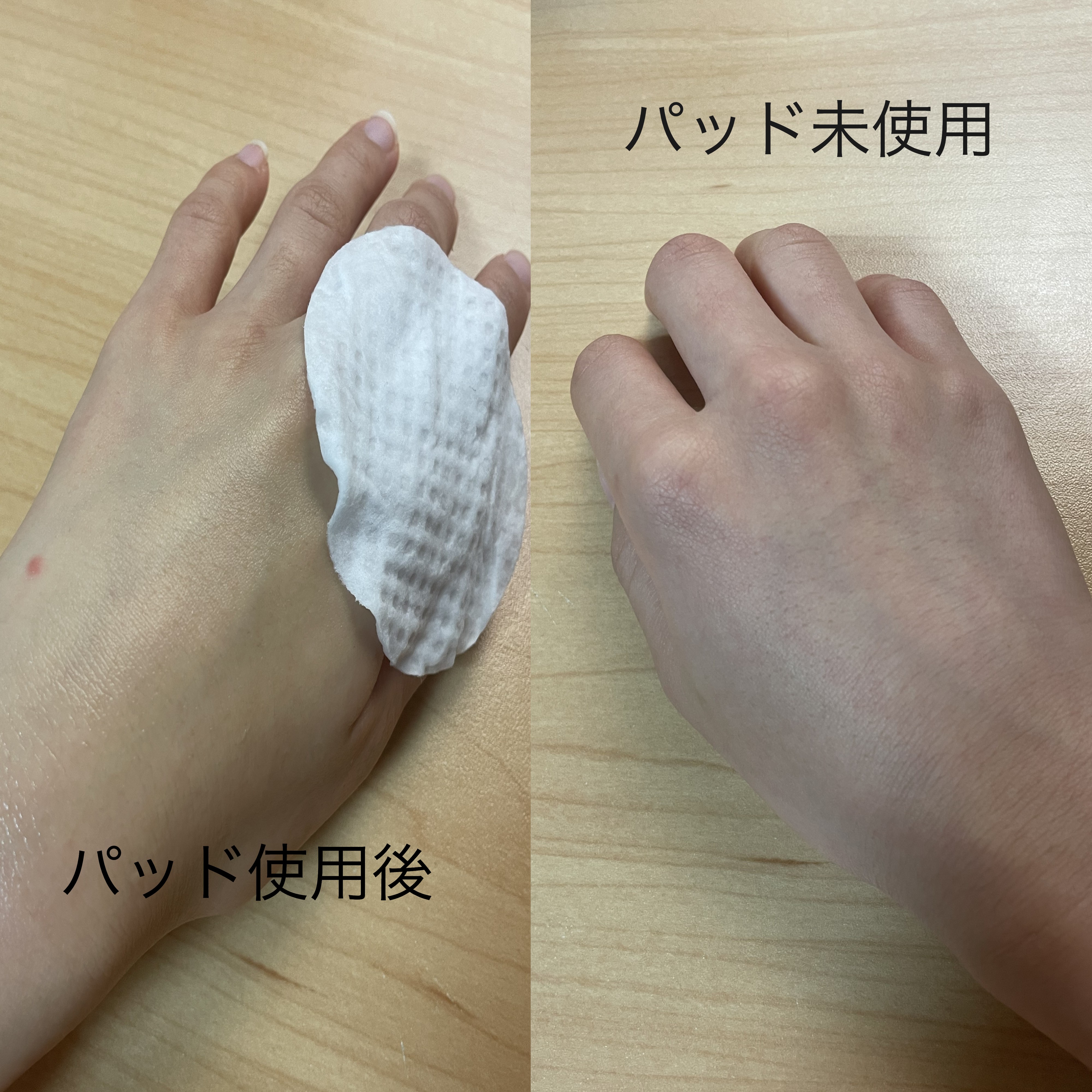 キャロットカロテン カーミングウォーターパッド/SKINFOOD/トナーパッドを使ったクチコミ（3枚目）