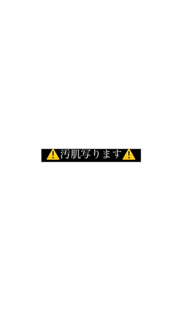 マスク フィット レッド クッション/TIRTIR(ティルティル)/クッションファンデーションを使ったクチコミ（2枚目）