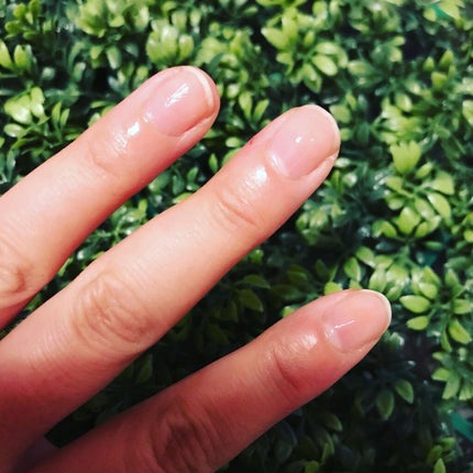 えり on LIPS 「北の快適工房 薬用クリアストロングショットアルファリニューアル..」(4枚目)