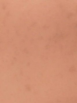 エッセンス スキングロウ ファンデーション/SHISEIDO/リキッドファンデーションを使ったクチコミ(4枚目)