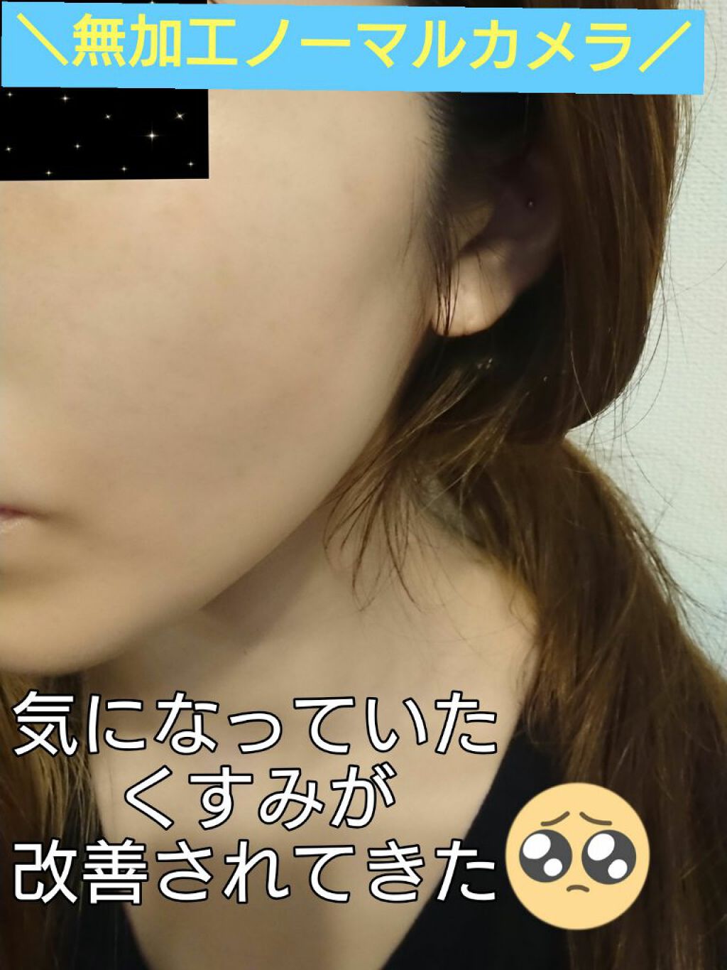 Beauty Function/ReBion/美容液を使ったクチコミ（2枚目）