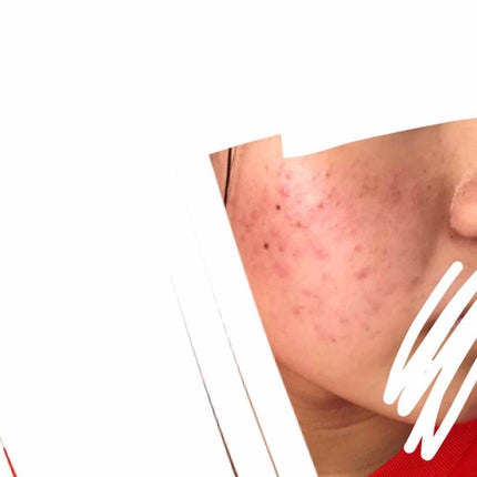 キビちゃん on LIPS 「おはようございます、こんにちは、こんばんは初めて投稿させて頂き..」(2枚目)