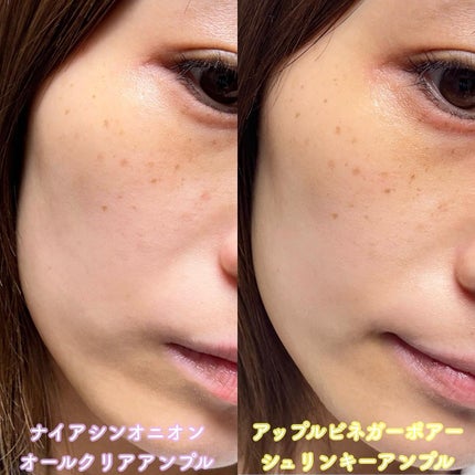 ナイアシンオニオン オールクリア アンプル/vividraw/美容液を使ったクチコミ(8枚目)