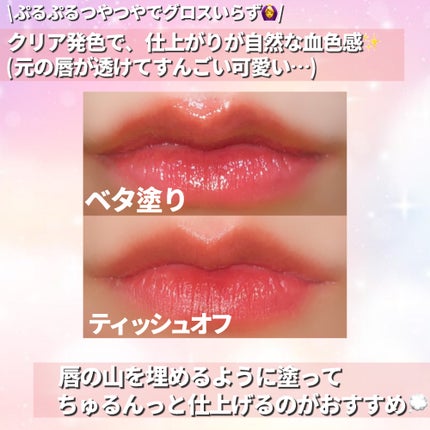 ãã€ãããã¥ã€ãã£ã³ã/Dear.A/ãªãããã£ã³ãã䜿ã£ãã¯ãã³ãïŒ3æç®ïŒ