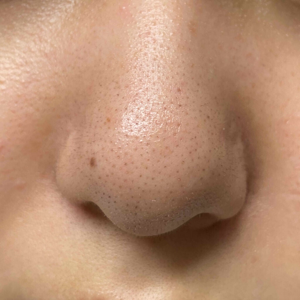 ハトムギ化粧水(ナチュリエ スキンコンディショナー R )/ナチュリエ/化粧水を使ったクチコミ(2枚目)