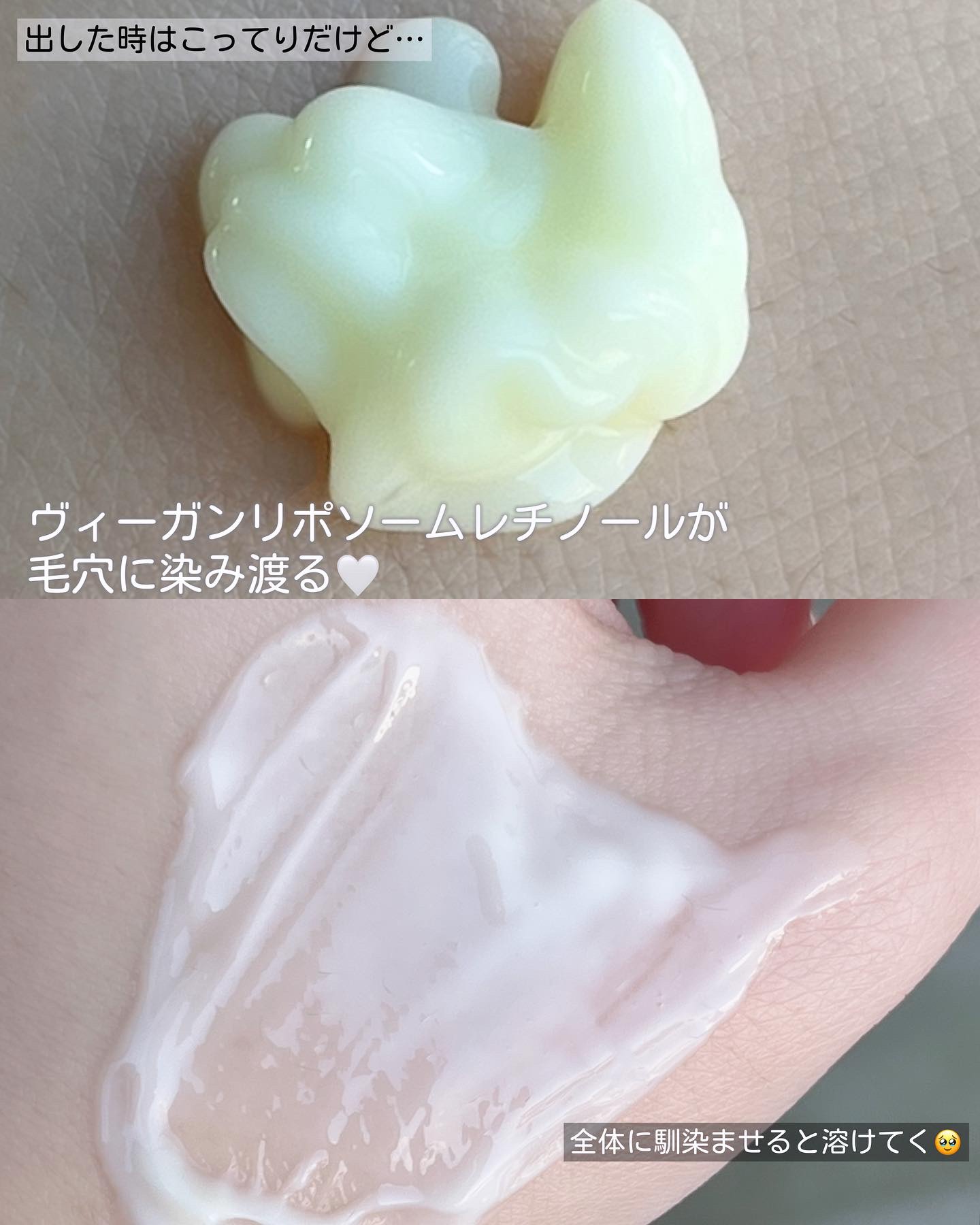 ヴィーガンリポソームレチノールセラム/SKIN&LAB/美容液を使ったクチコミ（3枚目）