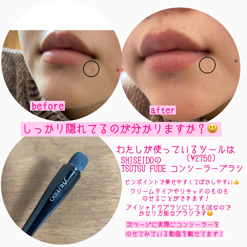 薬用コンシーラー アクネプロテクター/ONLY MINERALS/パウダーコンシーラーを使ったクチコミ（3枚目）