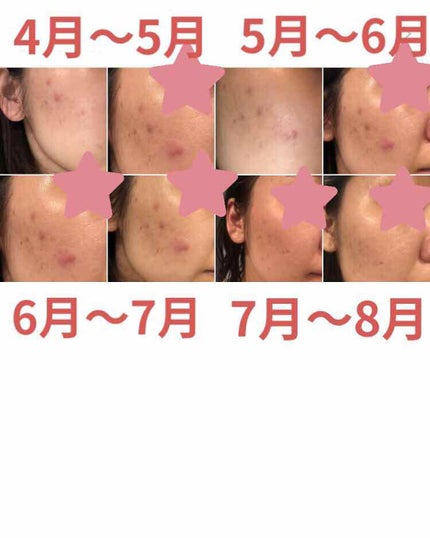 を使ったクチコミ(1枚目)