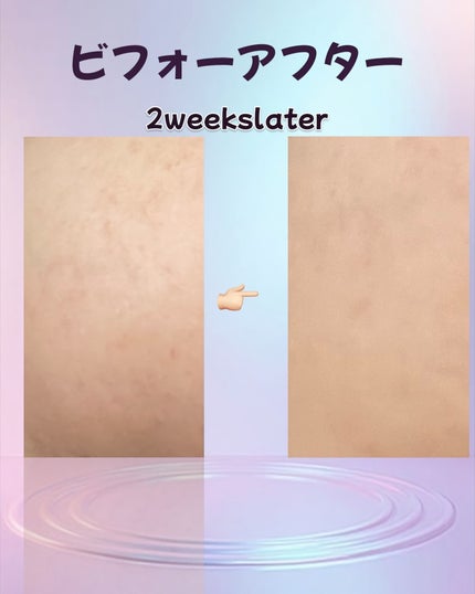 ミルクシスル リペアセラム/BANOBAGI/美容液を使ったクチコミ(5枚目)