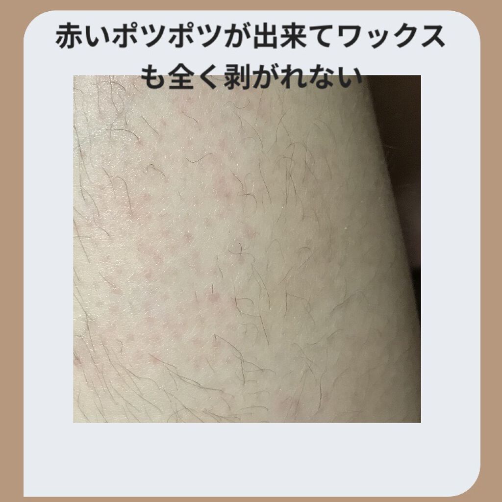 脱毛 ワックスシート/DAISO/除毛クリームを使ったクチコミ（3枚目）
