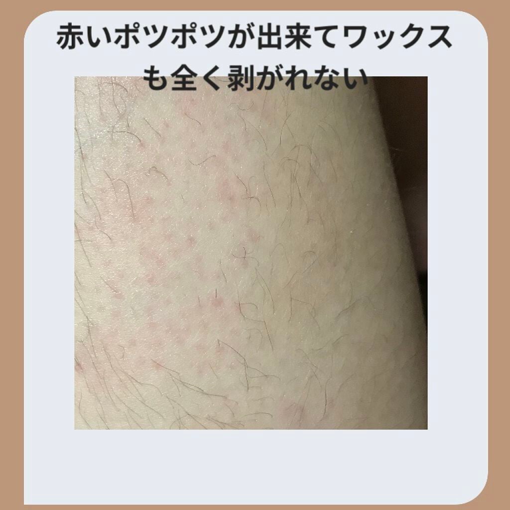 脱毛 ワックスシート/DAISO/除毛クリームを使ったクチコミ(3枚目)