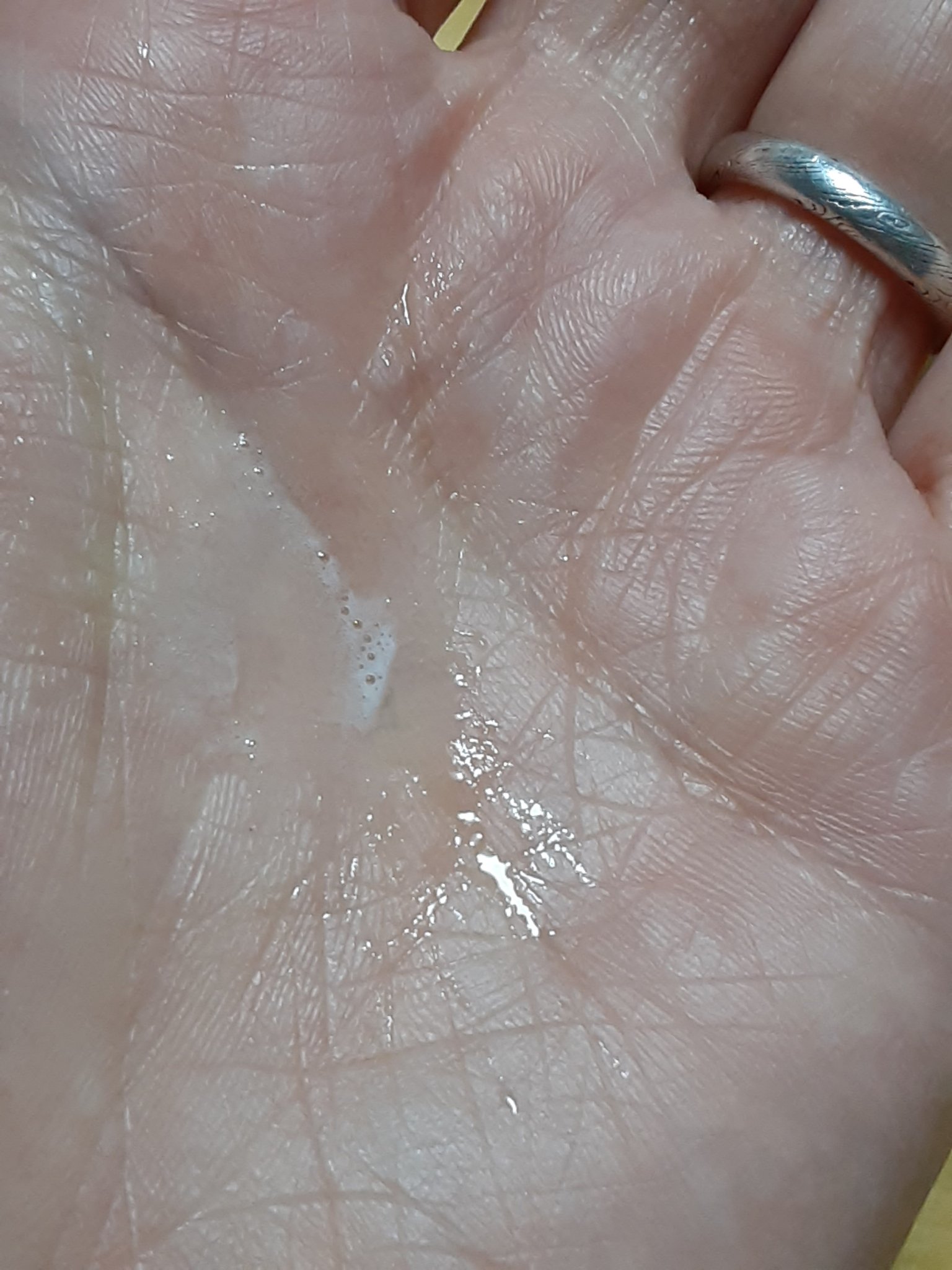 薬用育毛剤/ニューモ/頭皮ローションを使ったクチコミ（3枚目）