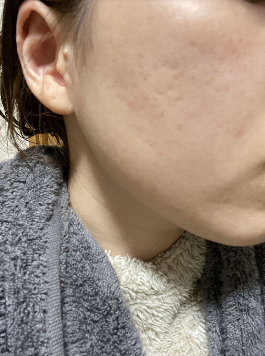 ビジャ ローション/innisfree/乳液を使ったクチコミ（1枚目）