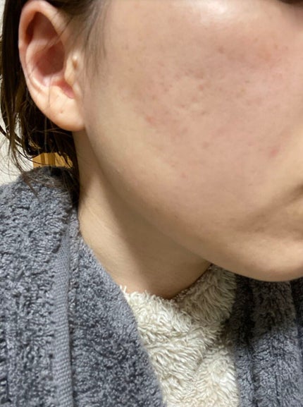 ビジャ ローション/innisfree/乳液を使ったクチコミ(1枚目)