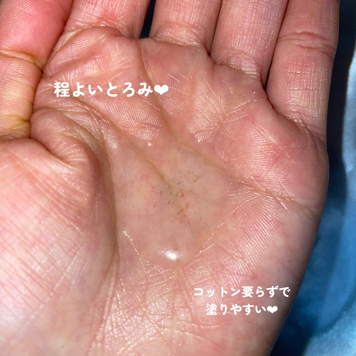 薬用マイクロバブルローション/Macchia Label/化粧水を使ったクチコミ(6枚目)