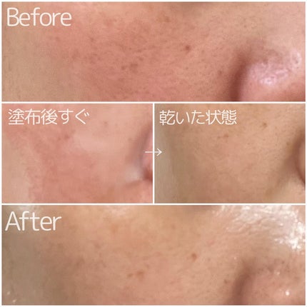 エクソソーム ペプチド グロウ パック/BloomAge/美容液を使ったクチコミ(5枚目)