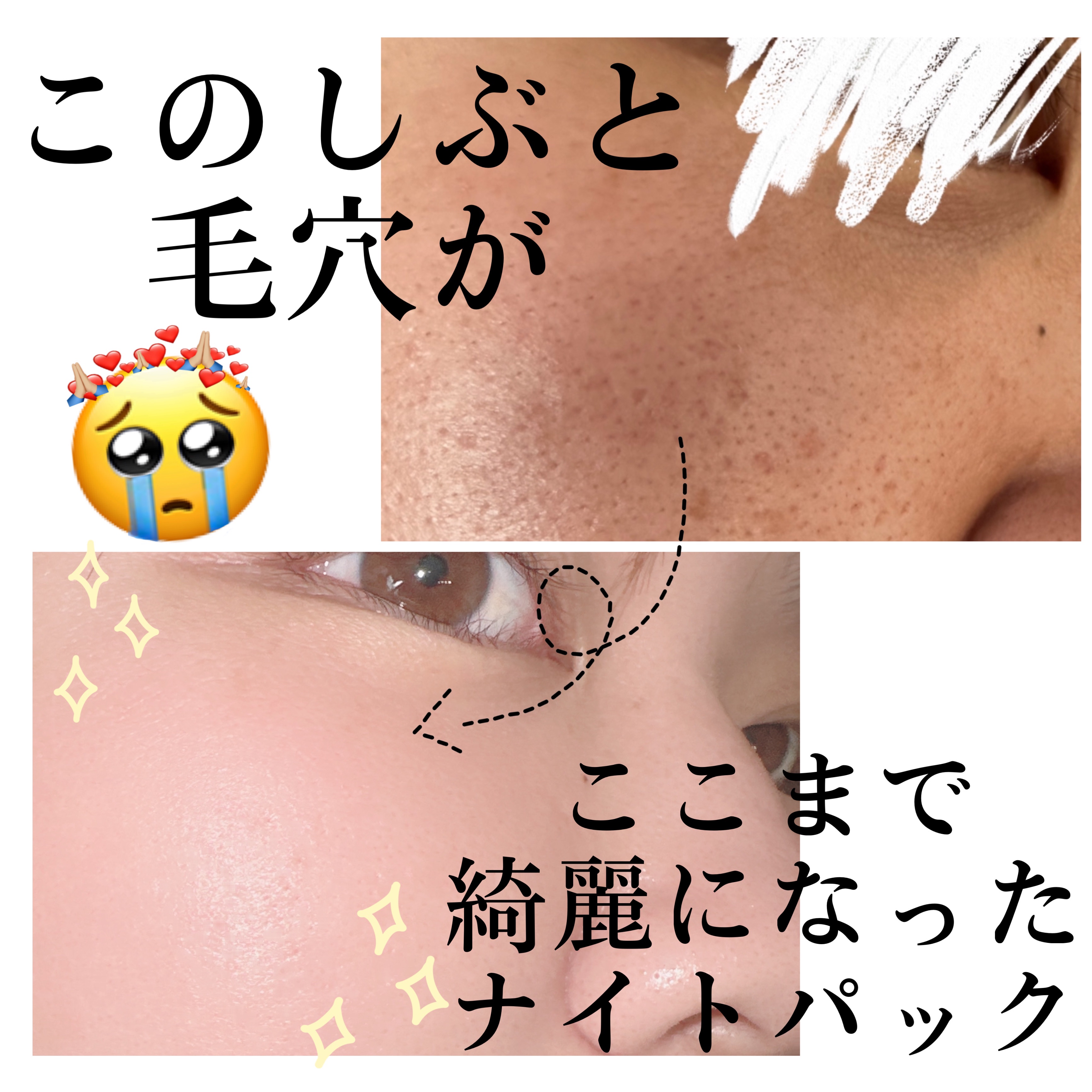 CICA スリーピングマスク/VT/シートマスク・パックを使ったクチコミ（1枚目）