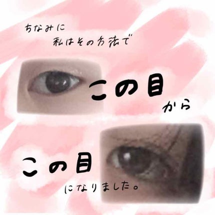 【旧品】オリシキ アイリッドスキンフィルム/D-UP/二重まぶた用アイテムを使ったクチコミ(2枚目)