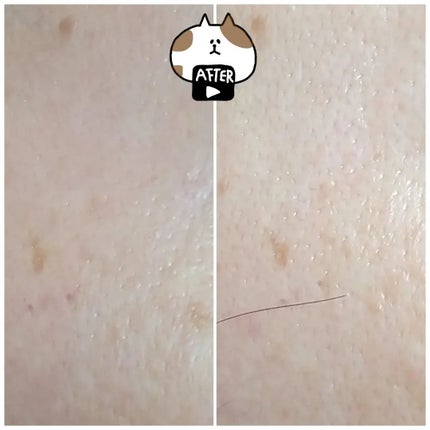 seiko_official on LIPS 「(/-\*)しみ~できちゃう。˗ˏˋ対策対策 ˎˊ˗#レディブ..」(4枚目)