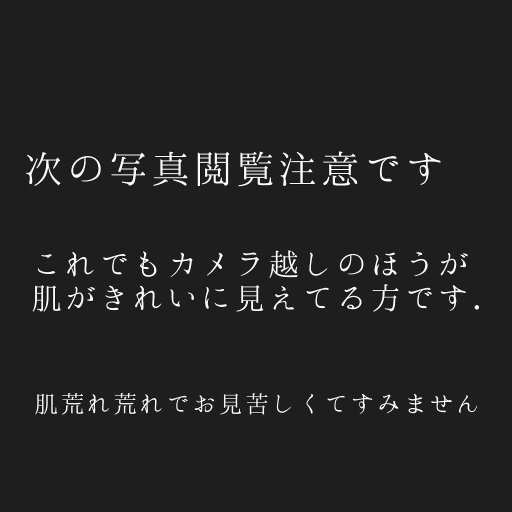 ティーツリーケア ソリューション エッセンシャルマスクEX/MEDIHEAL/シートマスク・パックを使ったクチコミ(2枚目)