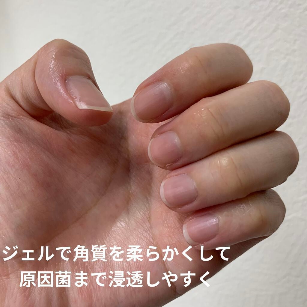 薬用 クリアストロングショット アルファ/北の快適工房/レッグ・フットケアを使ったクチコミ(5枚目)