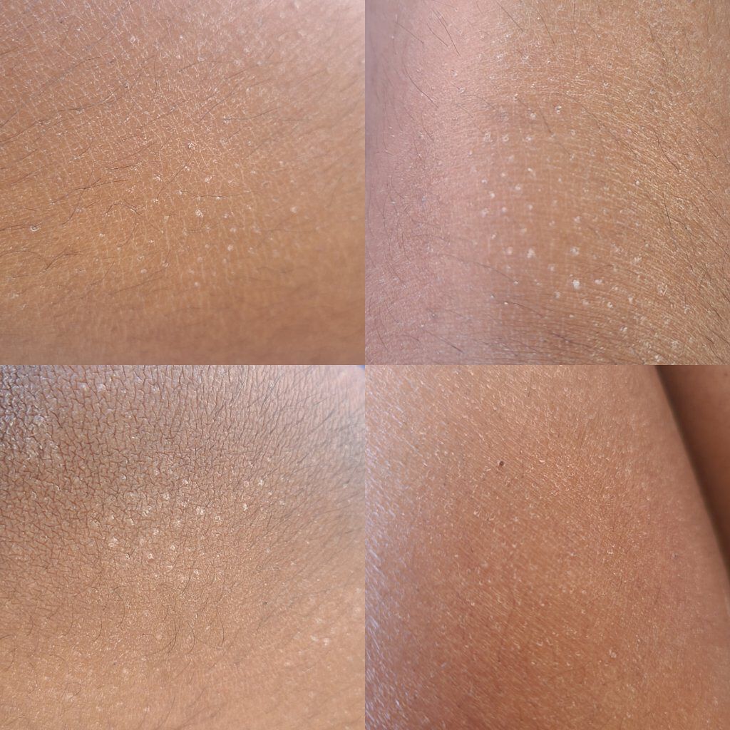 DAISO アロエ乳液のクチコミ「アロエ乳液 ダイソー 🔥辛口評価🔥

どうも！りむです
今回は、ダイソーで購入したアロエ乳液の.....」（3枚目）