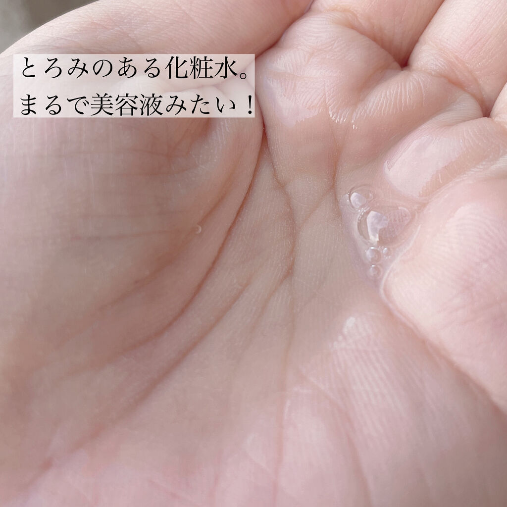 VC100エッセンスローション EX/ドクターシーラボⓇ/化粧水を使ったクチコミ（3枚目）