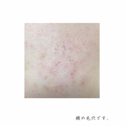 化粧水・敏感肌用・高保湿タイプ/無印良品/化粧水を使ったクチコミ(2枚目)