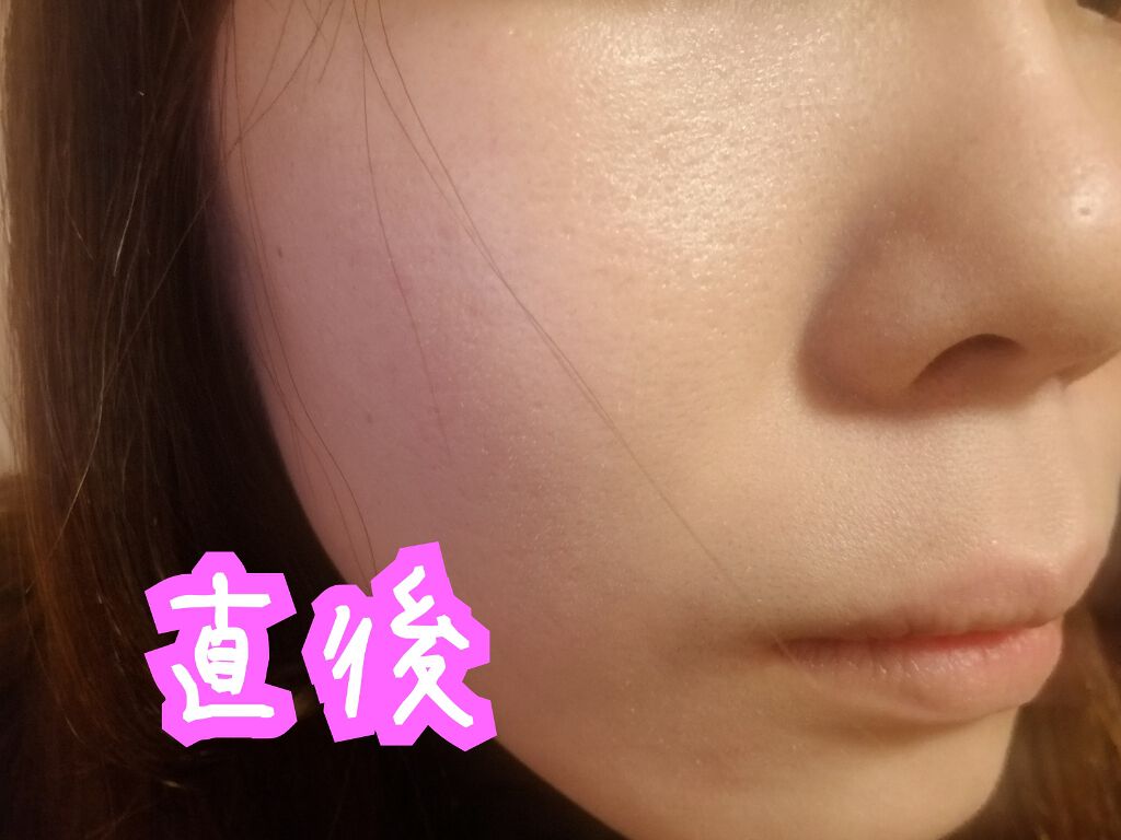 アレルバリア エッセンス BB/d プログラム/BBクリームを使ったクチコミ(2枚目)