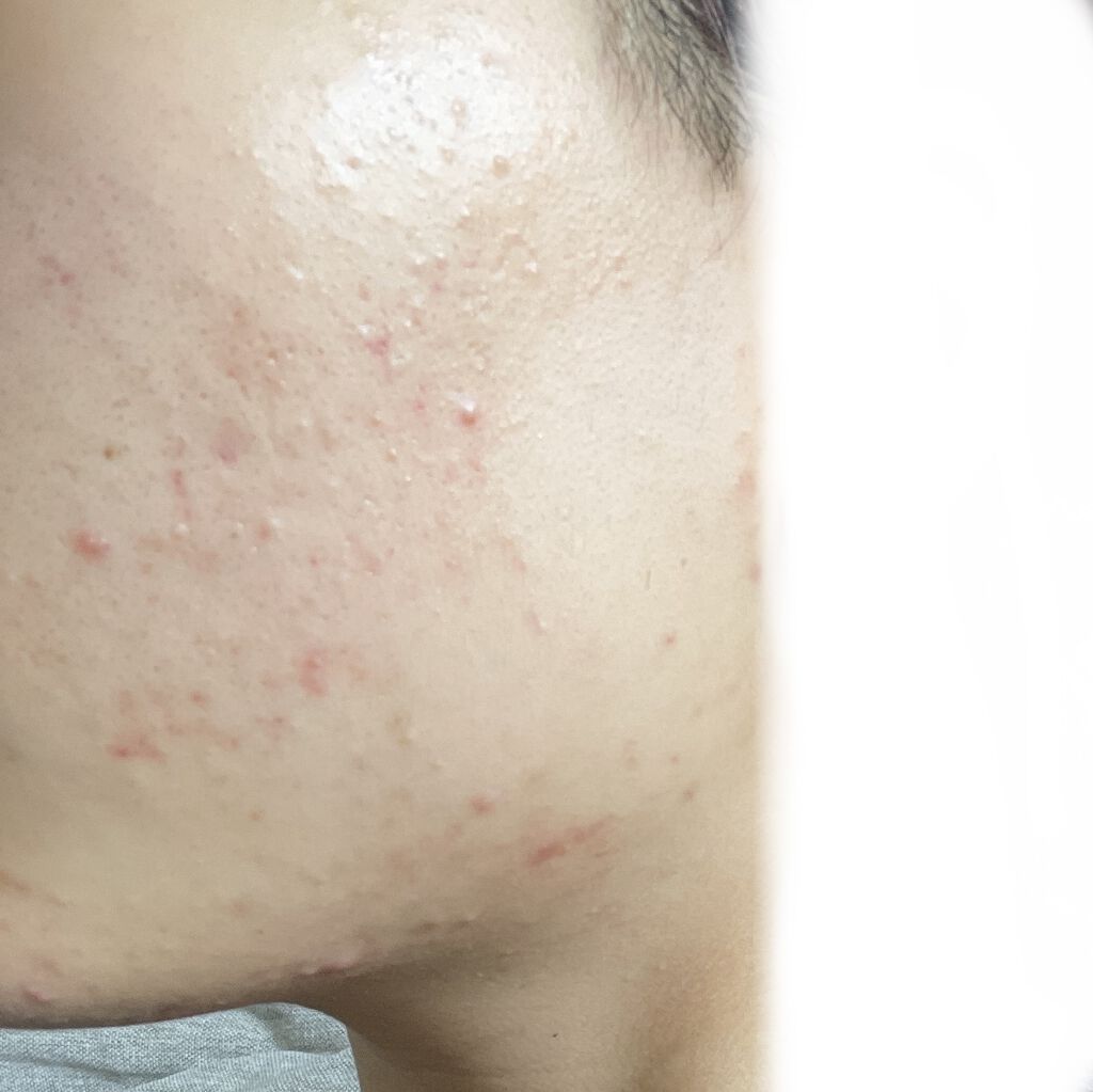 乳液・敏感肌用・高保湿タイプ/無印良品/乳液を使ったクチコミ（3枚目）