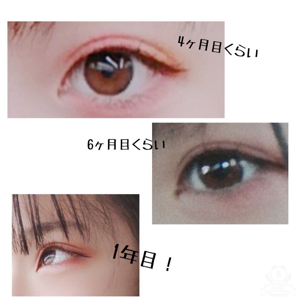 アイトーク/アイトーク/二重まぶた用アイテムを使ったクチコミ(3枚目)