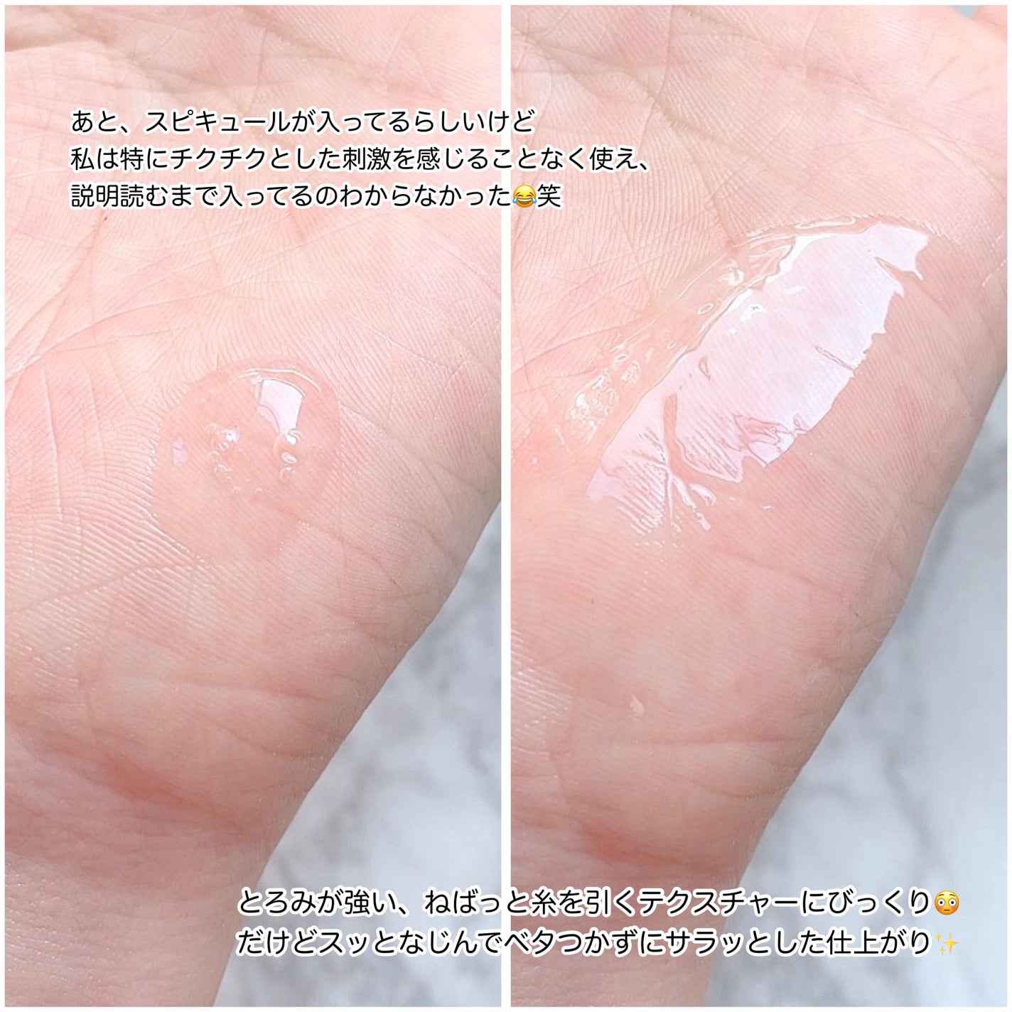 リマージ糸リフティングアンプル/REVENIP/美容液を使ったクチコミ(6枚目)