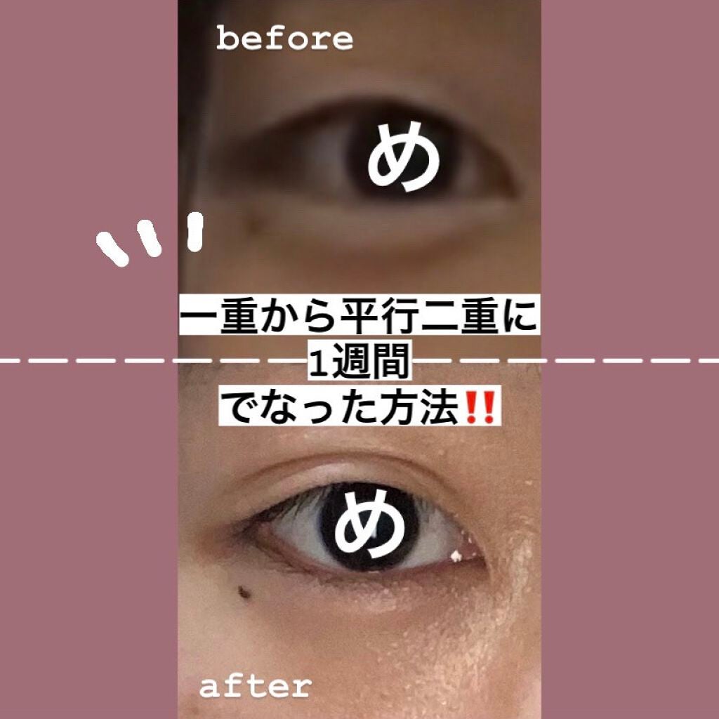 しなやかフィット/DAISO/二重まぶた用アイテムを使ったクチコミ(1枚目)