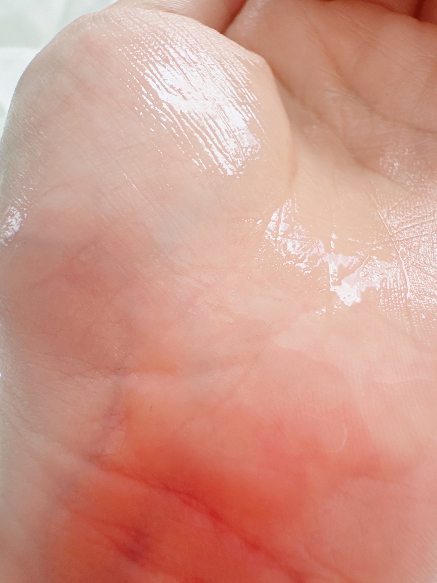 セラムヴェール ディープリペア/ONE BY KOSE/美容液を使ったクチコミ(4枚目)