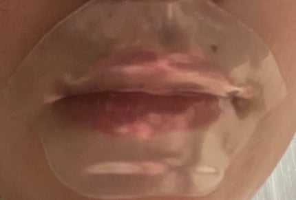 LIP PACK/ミオジャパン/リップマスクを使ったクチコミ(4枚目)