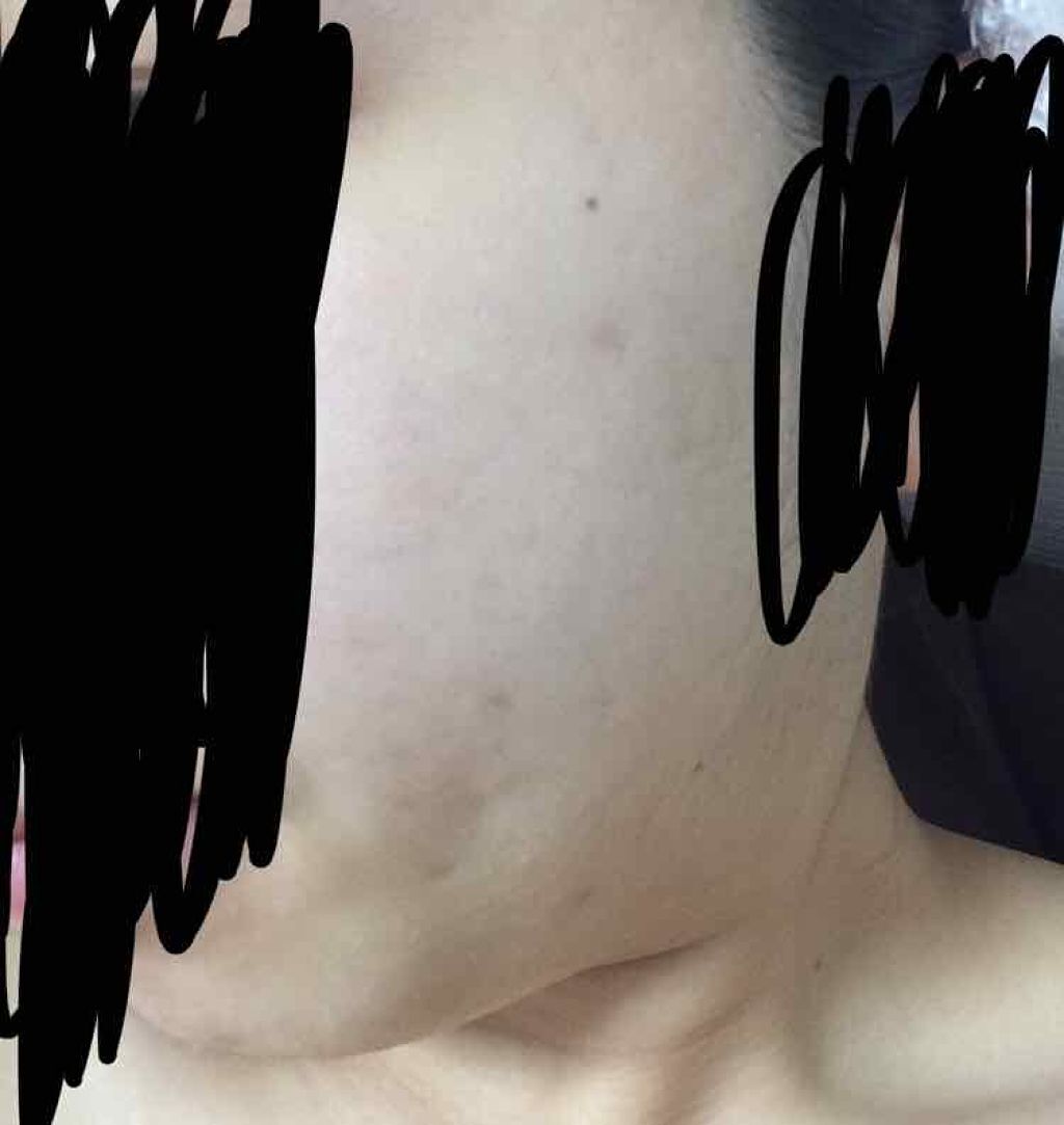 ハトムギ化粧水(ナチュリエ スキンコンディショナー R )/ナチュリエ/化粧水を使ったクチコミ（3枚目）