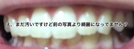 アパガードプレミオ/アパガード/歯磨き粉を使ったクチコミ(4枚目)