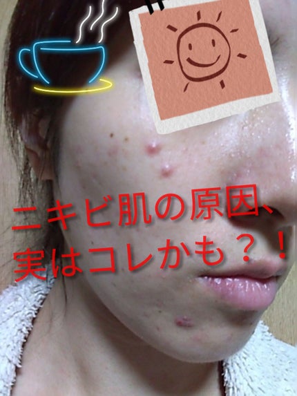 キッコーマン飲料 無調整豆乳のクチコミ「
今回はニキビの原因。実はコレでは?
というテーマでお送りします。
私は長年ニキビで悩ん.....」(1枚目)