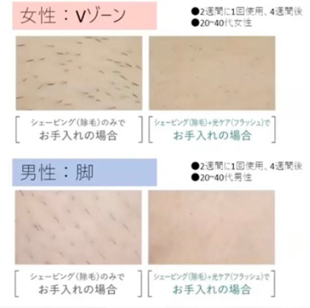 フェリエ フェイス用 ES-WF41/Panasonic/シェーバーを使ったクチコミ(4枚目)