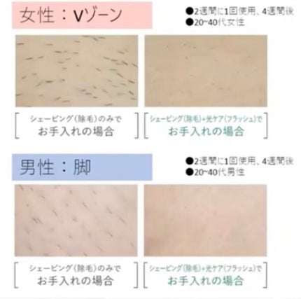 フェリエ フェイス用 ES-WF41/Panasonic/シェーバーを使ったクチコミ(4枚目)