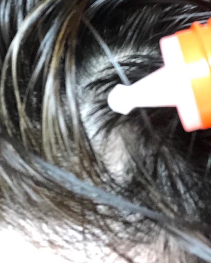 薬用RJ地肌ケアエッセンス/アピセラピーコスメティクス/頭皮ローションを使ったクチコミ(7枚目)