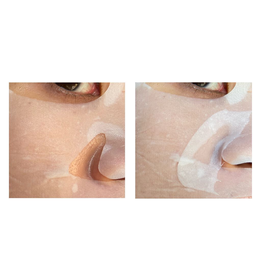 潤浸保湿 モイストリペアシートマスク/キュレル/シートマスク・パックを使ったクチコミ(5枚目)