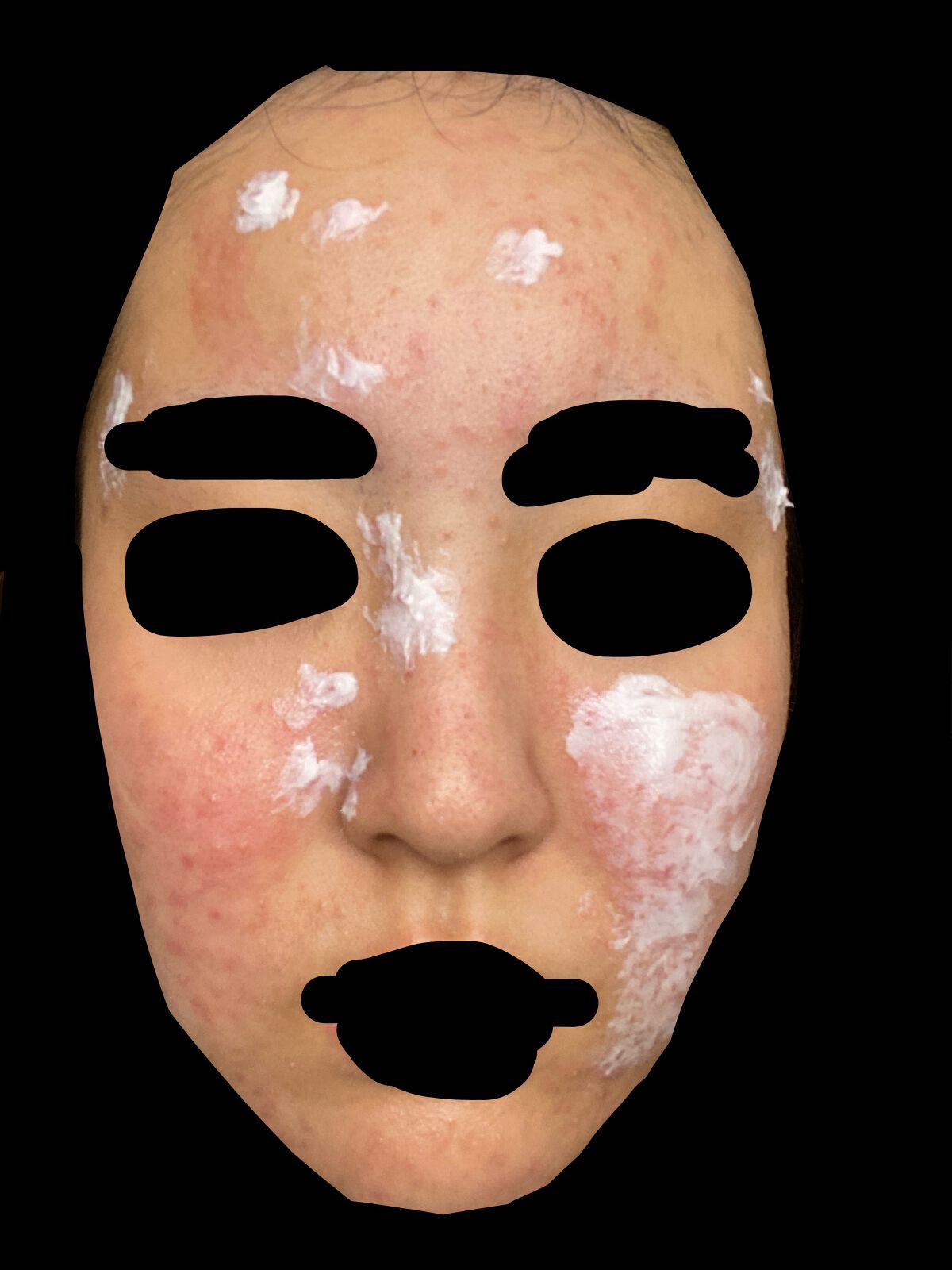 オードムーゲ 薬用ローション(ふきとり化粧水)/オードムーゲ/拭き取り化粧水を使ったクチコミ(3枚目)