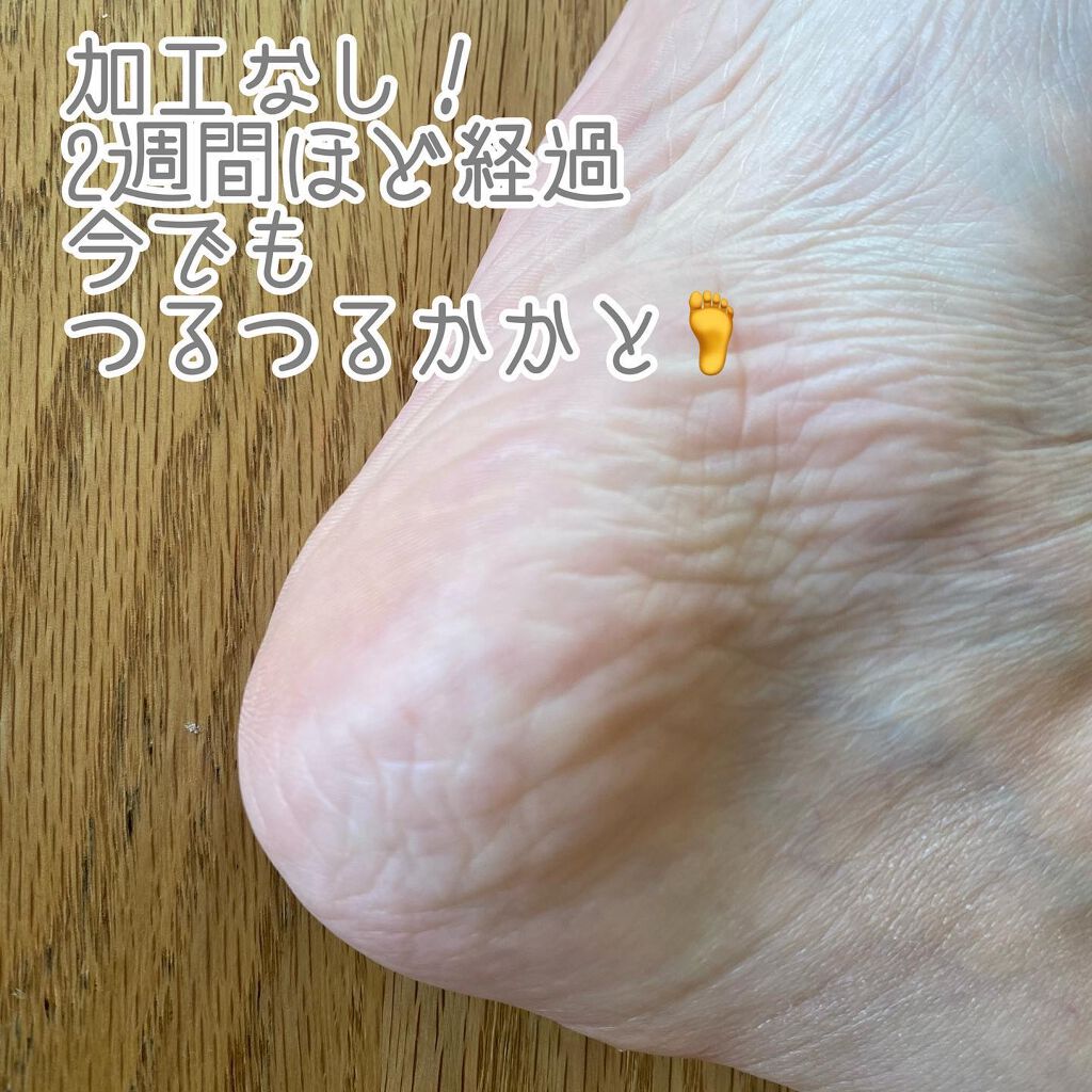 ベビーフット・シトラス/ベビーフット/その他キットセットを使ったクチコミ（3枚目）