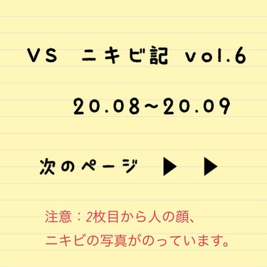 新ビオフェルミンS錠 /ビオフェルミン/健康サプリメントを使ったクチコミ（1枚目）