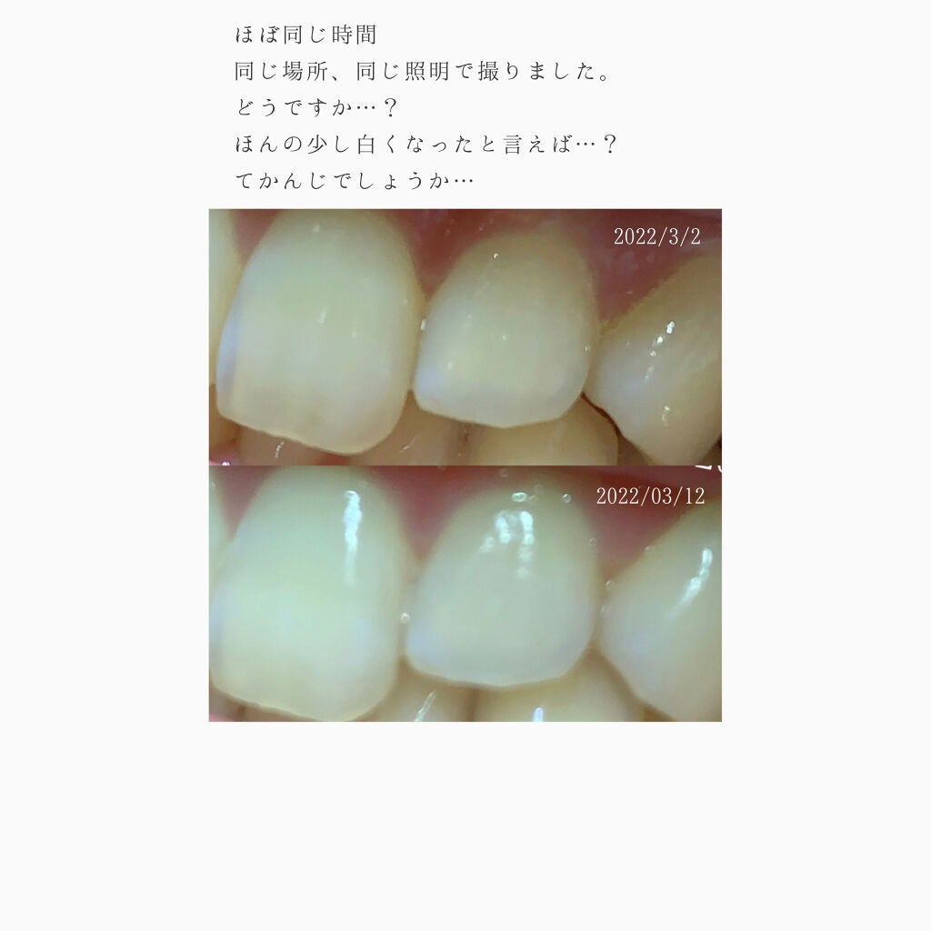 ホワイティエッセンス/MiiS/その他オーラルケアを使ったクチコミ(4枚目)