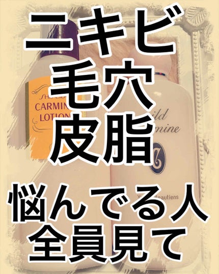 カーマインローション(N)/SHISEIDO/化粧水を使ったクチコミ(1枚目)