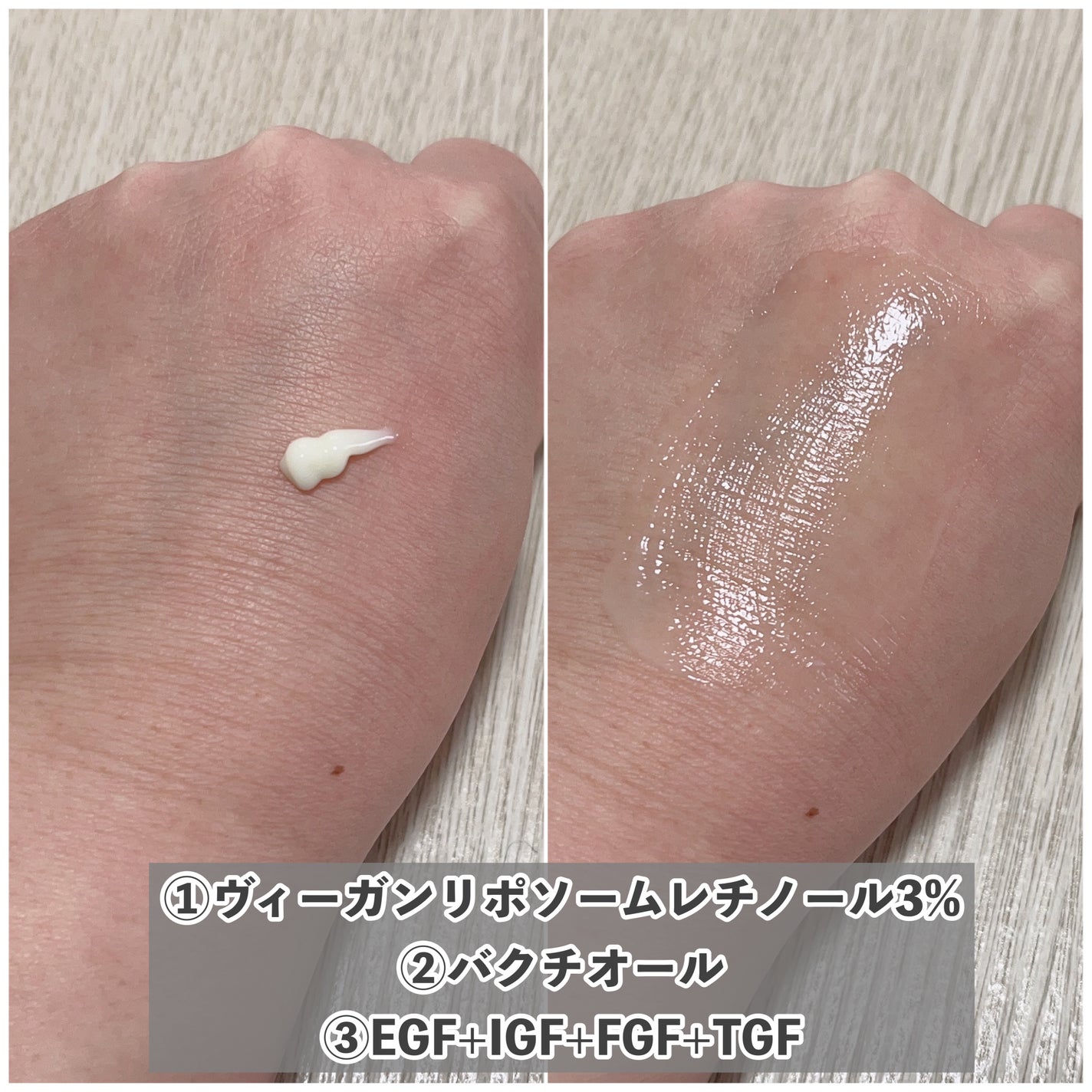 バリアダームモイストクリーム/SKIN&LAB/フェイスクリームを使ったクチコミ(5枚目)