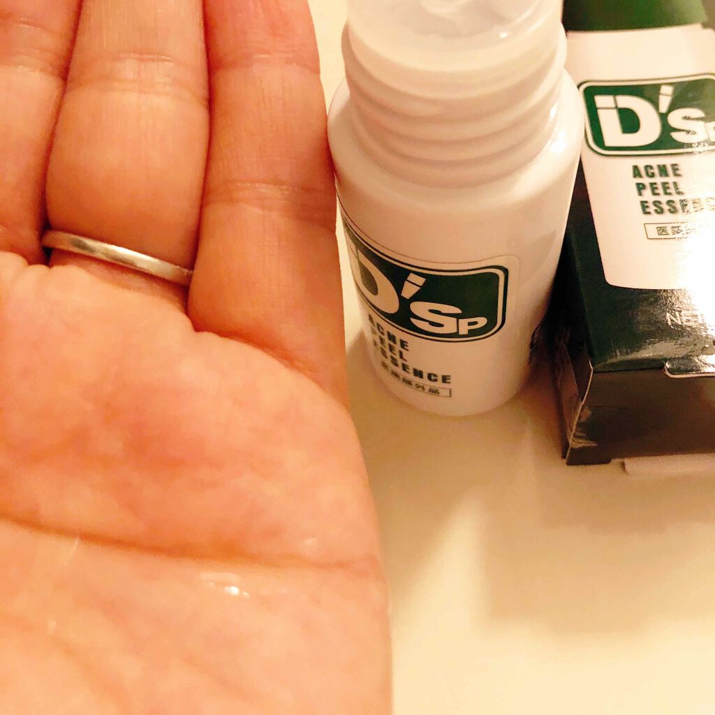 薬用アクネピールエッセンス/プレビュート/ピーリングを使ったクチコミ（1枚目）